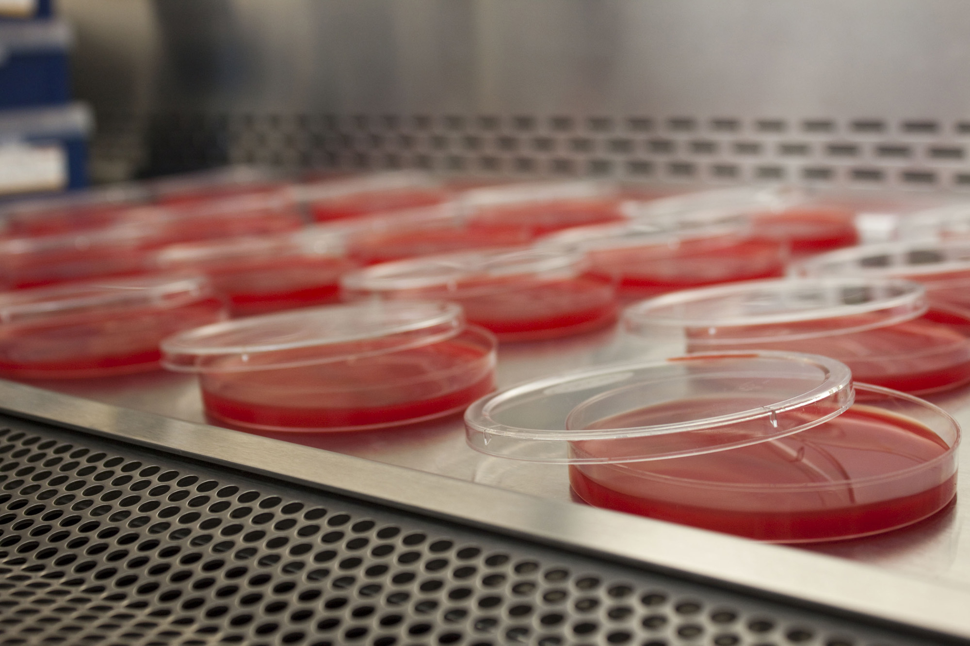 Blood Agar Plates